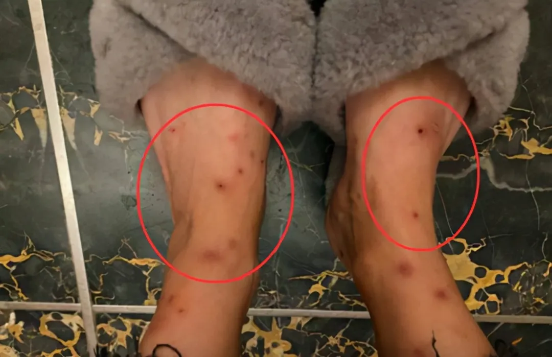 一（yī）小區跳（tiào）蚤泛濫！跳蚤究竟哪來的？